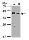 PKACA antibody, PA5-28604, Invitrogen Antibodies, Western Blot image 