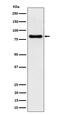 Scinderin antibody, M07463, Boster Biological Technology, Western Blot image 
