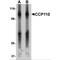 Centrosomal protein CP110 antibody, MBS151298, MyBioSource, Western Blot image 