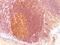 MALT1 Paracaspase antibody, orb387968, Biorbyt, Immunohistochemistry paraffin image 