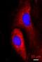 Cytoplasmic dynein 1 intermediate chain 1 antibody, NB300-726, Novus Biologicals, Immunocytochemistry image 