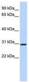 BCAS2 Pre-MRNA Processing Factor antibody, TA345936, Origene, Western Blot image 