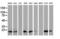 Destrin, Actin Depolymerizing Factor antibody, M03849-1, Boster Biological Technology, Western Blot image 