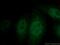 p38 mapk antibody, 14064-1-AP, Proteintech Group, Immunofluorescence image 