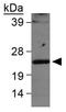 LIM Domain Only 2 antibody, GTX48597, GeneTex, Western Blot image 