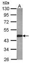 Branched Chain Amino Acid Transaminase 2 antibody, PA5-21549, Invitrogen Antibodies, Western Blot image 