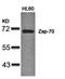 Zeta Chain Of T Cell Receptor Associated Protein Kinase 70 antibody, orb14569, Biorbyt, Western Blot image 