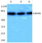 Ecto-apyrase antibody, AP21170PU-N, Origene, Western Blot image 