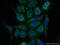 Protein Phosphatase 2 Regulatory Subunit B'Epsilon antibody, 23885-1-AP, Proteintech Group, Immunofluorescence image 