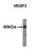Vascular Endothelial Growth Factor C antibody, LS-C96436, Lifespan Biosciences, Western Blot image 