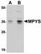 Transmembrane Protein 173 antibody, orb75241, Biorbyt, Western Blot image 