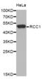 Regulator Of Chromosome Condensation 1 antibody, abx004853, Abbexa, Western Blot image 