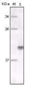 MER Proto-Oncogene, Tyrosine Kinase antibody, NBP1-47373, Novus Biologicals, Western Blot image 