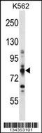 Carnitine Palmitoyltransferase 1A antibody, 57-900, ProSci, Western Blot image 
