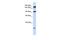 ATP Binding Cassette Subfamily A Member 5 antibody, PA5-42402, Invitrogen Antibodies, Western Blot image 