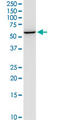 Neuraminidase 1 antibody, LS-B13952, Lifespan Biosciences, Western Blot image 