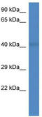 PCI Domain Containing 2 antibody, TA344864, Origene, Western Blot image 