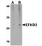 EF-Hand Domain Family Member D2 antibody, NBP1-77135, Novus Biologicals, Western Blot image 