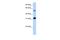Succinyl-CoA:3-ketoacid-coenzyme A transferase 1, mitochondrial antibody, A07229, Boster Biological Technology, Western Blot image 