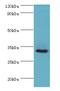 Carbonic Anhydrase 8 antibody, MBS968840, MyBioSource, Western Blot image 