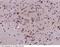 Carbonic Anhydrase 8 antibody, 50767-T60, Sino Biological, Immunohistochemistry paraffin image 