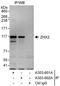 Zinc Fingers And Homeoboxes 2 antibody, A303-602A, Bethyl Labs, Immunoprecipitation image 