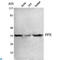 Serine/threonine-protein phosphatase 4 catalytic subunit antibody, LS-C813098, Lifespan Biosciences, Western Blot image 
