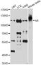 Androgen Receptor antibody, A0330, ABclonal Technology, Western Blot image 