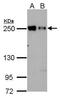 Eukaryotic Translation Initiation Factor 4 Gamma 3 antibody, PA5-31101, Invitrogen Antibodies, Western Blot image 