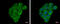 Follicle-stimulating hormone receptor antibody, GTX108202, GeneTex, Immunofluorescence image 