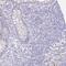 SUZ12 Polycomb Repressive Complex 2 Subunit antibody, HPA057436, Atlas Antibodies, Immunohistochemistry frozen image 