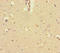 Potassium Channel Tetramerization Domain Containing 16 antibody, LS-C394477, Lifespan Biosciences, Immunohistochemistry paraffin image 