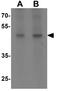 WD repeat domain phosphoinositide-interacting protein 1 antibody, GTX31497, GeneTex, Western Blot image 