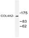 Collagen Type IV Alpha 2 Chain antibody, AP20477PU-N, Origene, Western Blot image 
