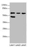 Feline Leukemia Virus Subgroup C Cellular Receptor Family Member 2 antibody, orb40413, Biorbyt, Western Blot image 