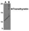 Transthyretin antibody, OAPB00883, Aviva Systems Biology, Western Blot image 