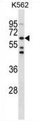 Testis Associated Actin Remodelling Kinase 1 antibody, AP54219PU-N, Origene, Western Blot image 