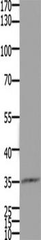 Homeobox D11 antibody, TA322228, Origene, Western Blot image 