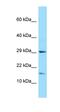 Uncharacterized protein C21orf67 antibody, orb325236, Biorbyt, Western Blot image 