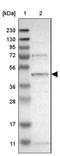 Solute carrier family 41 member 1 antibody, NBP1-82652, Novus Biologicals, Western Blot image 