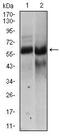 Hyaluronan synthase 2 antibody, MA5-17087, Invitrogen Antibodies, Western Blot image 