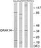 Olfactory Receptor Family 4 Subfamily K Member 14 antibody, TA316063, Origene, Western Blot image 