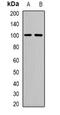 N-Acylsphingosine Amidohydrolase 2 antibody, orb341412, Biorbyt, Western Blot image 