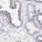 F-Box Protein 10 antibody, HPA002863, Atlas Antibodies, Immunohistochemistry frozen image 