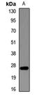 Protein FAM3B antibody, orb411825, Biorbyt, Western Blot image 