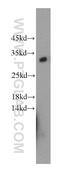 Potassium Channel Tetramerization Domain Containing 14 antibody, 21111-1-AP, Proteintech Group, Western Blot image 