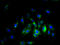 Solute Carrier Family 38 Member 5 antibody, A60998-100, Epigentek, Immunofluorescence image 