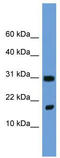 Heparin-binding growth factor 1 antibody, TA334681, Origene, Western Blot image 