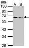 Arylsulfatase A antibody, GTX106155, GeneTex, Western Blot image 