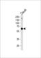 Ubiquitin Specific Peptidase 22 antibody, LS-C203921, Lifespan Biosciences, Western Blot image 